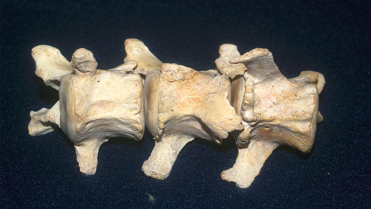 Spinal Lengthening Method